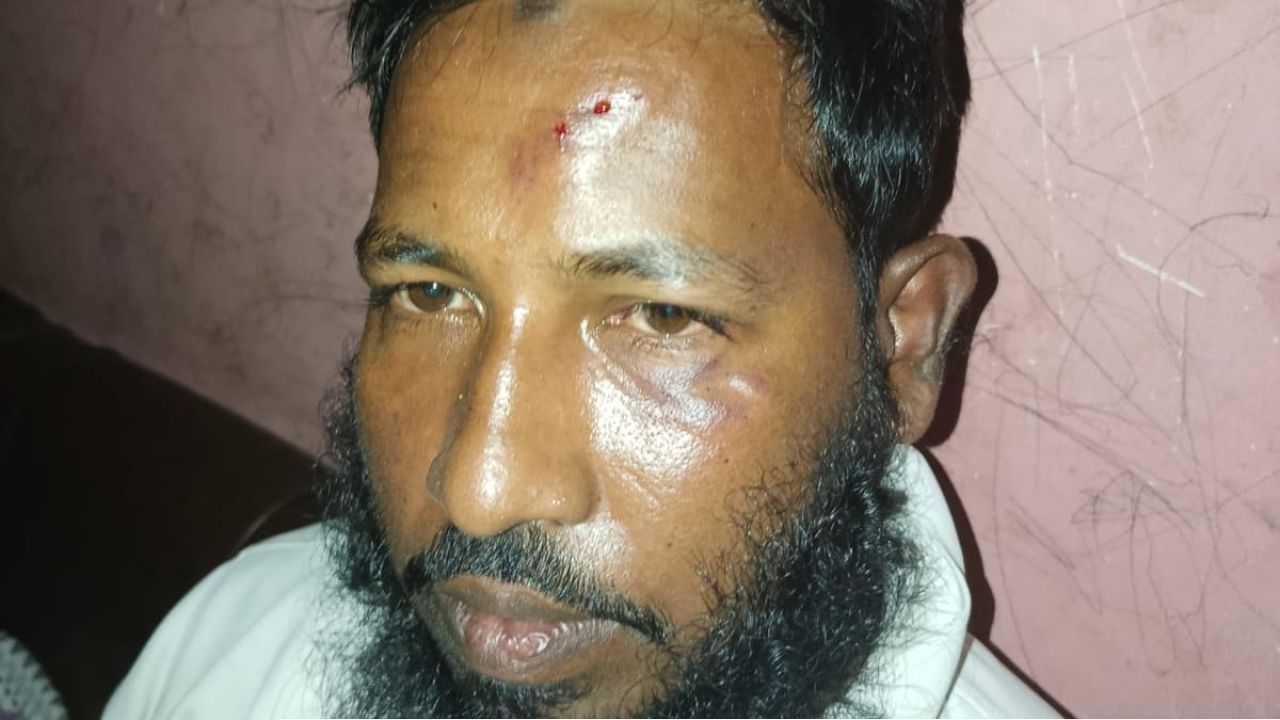জামায়াত নেতার উপর হামলার অভিযোগ